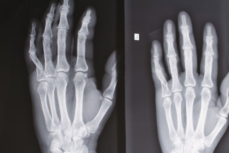 あなたにぴったりの歯科矯正おすすめガイド